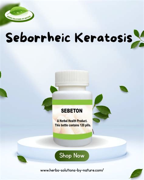 How To Use Apple Cider Vinegar Treatment For Seborrheic Keratosis