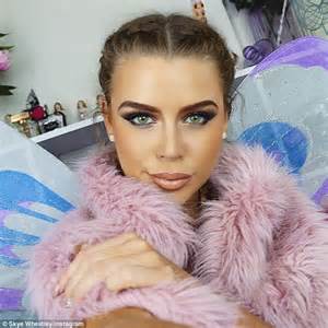 Skye Wheatley Is Unrecognisable After Lip Fillers And A Nose Job