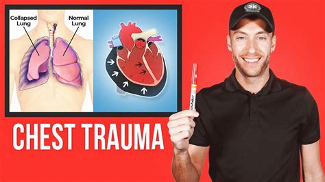 Easy Guide For Chest Trauma Youtube