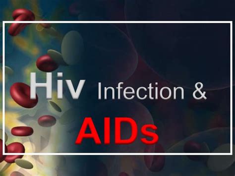 Hiv And Aids A Guide To Infection Stages Treatment And Management Ppt