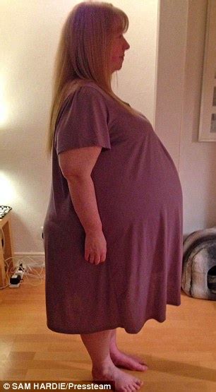 Woman Ballooned To Size 26 Because Of Five Stone Ovarian Cyst Daily