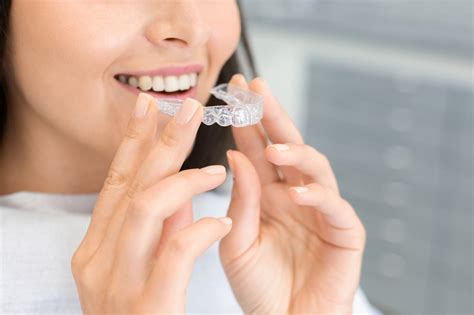 Invisible Braces In Plano Texas Everything You Need To Know