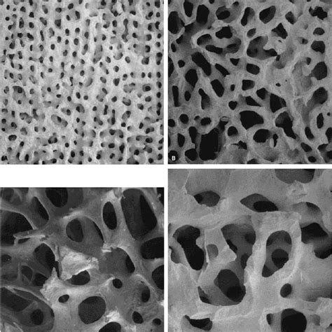 Types Of Allograft Bone Download Table