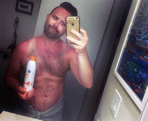 Too Much Sun Epic Tan Fails Shared On Instagram Daily Star