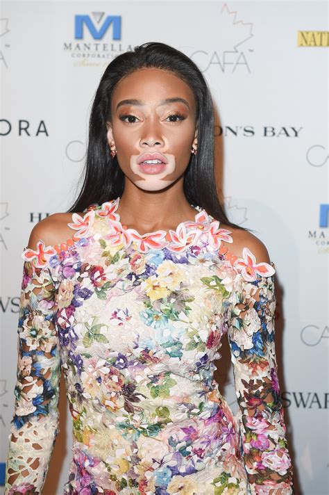 Model Winnie Harlow Says Shes Much More Than Her Vitiligo