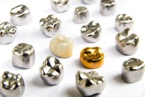 Once your tooth is prepared for a dental crown and measurements are made, your dentist will fix a temporary crown on the prepared. Ask the Dentist: "How Much Does a Dental Crown Cost?" - Dr ...