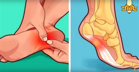 Consejos para aliviar el dolor en la planta del pie. ¿Te duele la planta del pie al pisar? Entonces tienes que ...