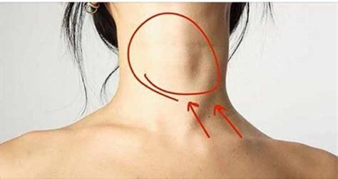 Every Second Woman Has A Problem With The Thyroid Gland 8 Important