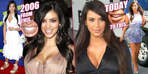 transformed by surgery kim kardashian s nip tuck obsession exposed