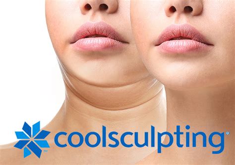 Coolsculpting Double Chin Utah Skin And Sculpt Medical Spa