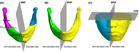 Segmentation Of The Mandible And Lower Facial Soft Tissue A Mandible