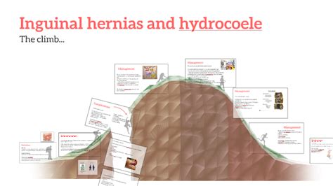 Inguinal Hernias And Hydrocele By Limay Ding
