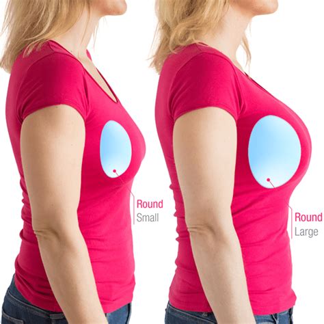 What Makes Breast Implants Look Natural Naples Fl