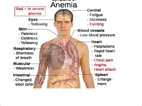 Anemia In Children презентация онлайн
