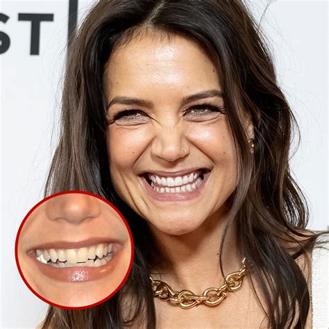 Morgan Freeman Teeth Fixed