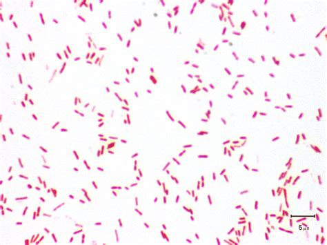 Bacteria, disease, escherichia coli, pathogens, microscopy. Escherichia Coli Under Microscope 100x - Micropedia