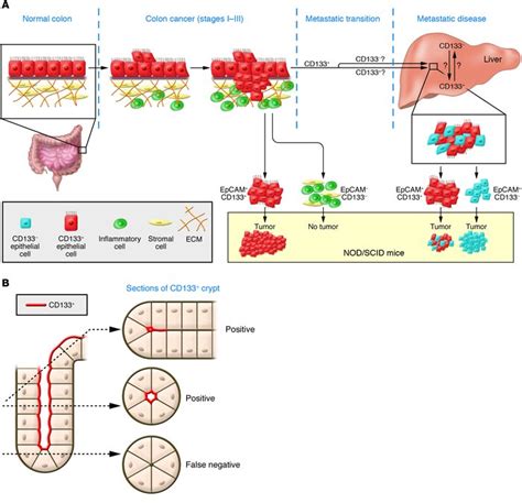 Colon cancer typically affects older adults, though it can happen at any age. CA 19-9 markeri tumorali - Cancer colon marker