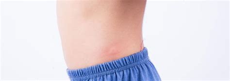 10 Common Types Of Skin Rashes You Should Be Aware Of Blog