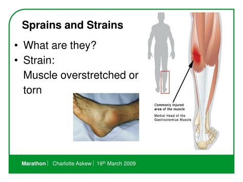 Sprain And Strain Prevention Seven Ways To Prevent Sprains And Strains