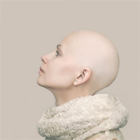 Baldandbadchallenge Is Beautifully Inspiring Portrait Photography Bald Women Caucasian Woman