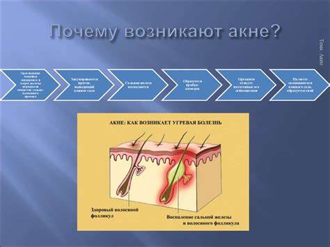 Воспаления щитовидной железы диета Диета от воспаления сальной железы - фото презентация Диета от воспаления сальной железы - фото презентация Воспаления щитовидной железы диета