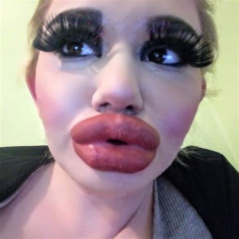 Andrea Ivanova Has Lip Injections To Look Like Idol Barbie News