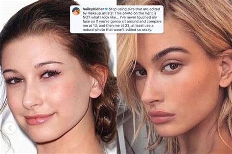 Hailey Baldwin Shuts Down Accusations She Got Plastic Surgery And