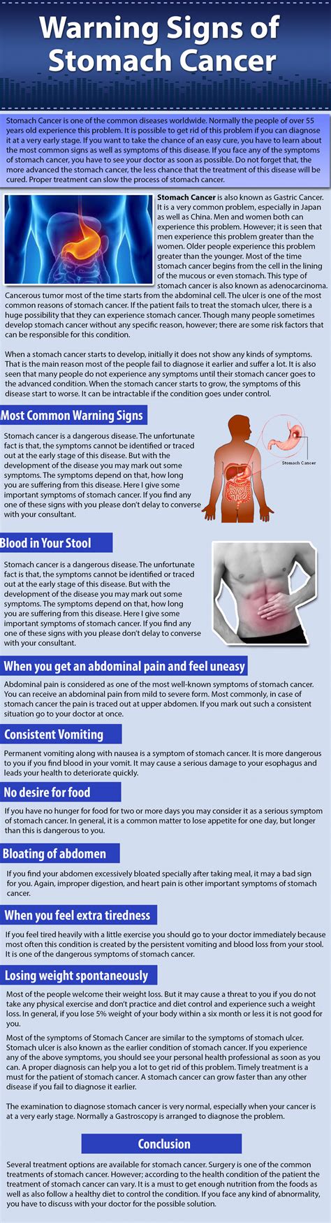Warning Signs Of Stomach Cancer Visually
