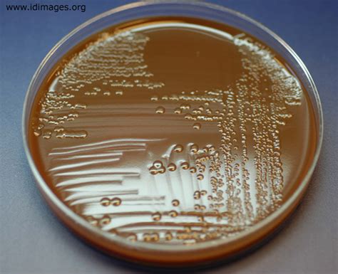 Media Types Microbiology Learning The Whyology Of Microbial Testing