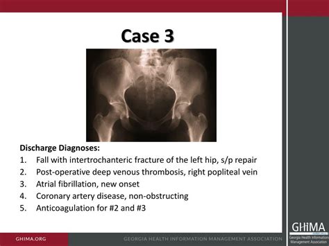 PPT - ICD-10 Coding Session Pulmonology PowerPoint ...