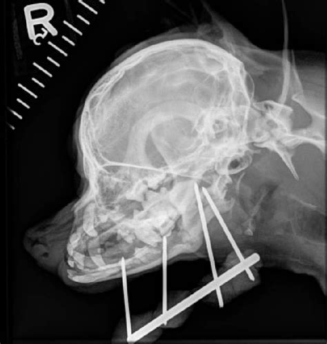 Lateral Oblique Radiograph Of The Patients Left Mandible Taken 6