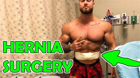 Chris Bumstead Hernia Surgery Youtube
