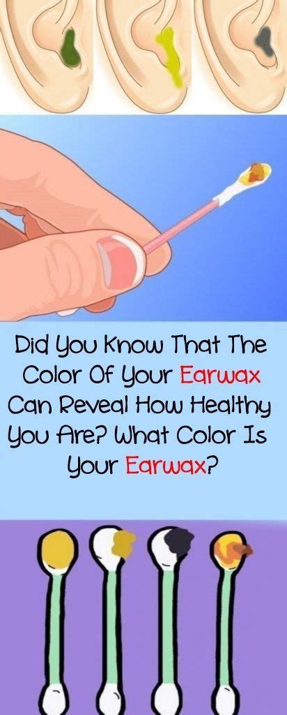 Ear Wax Color Chart