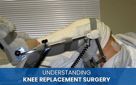 Understanding Knee Replacement Surgery Procedure Recovery And Risks