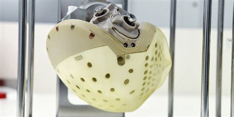 Carmat Artificial Heart Implanted For The First Time On A Woman