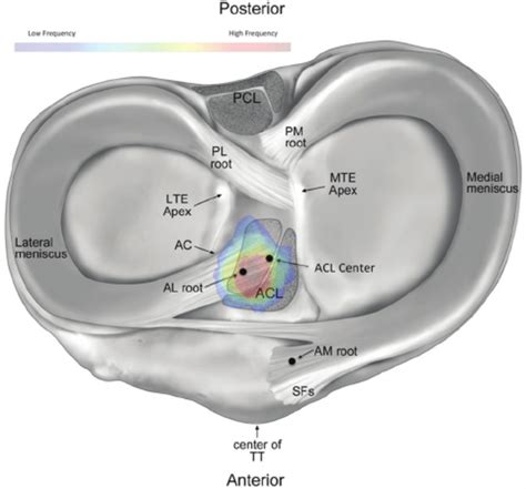 The Native Insertion Of The Anterior Root Of The Lateral Meniscus