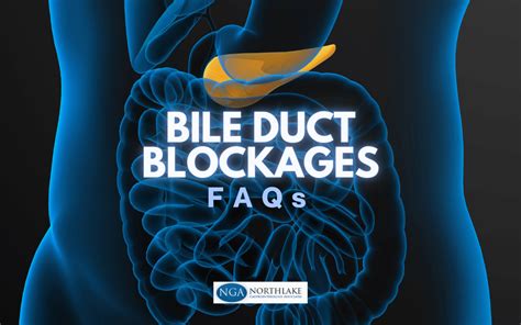 Faqs About Bile Duct Blockage Ercp For People Over 50