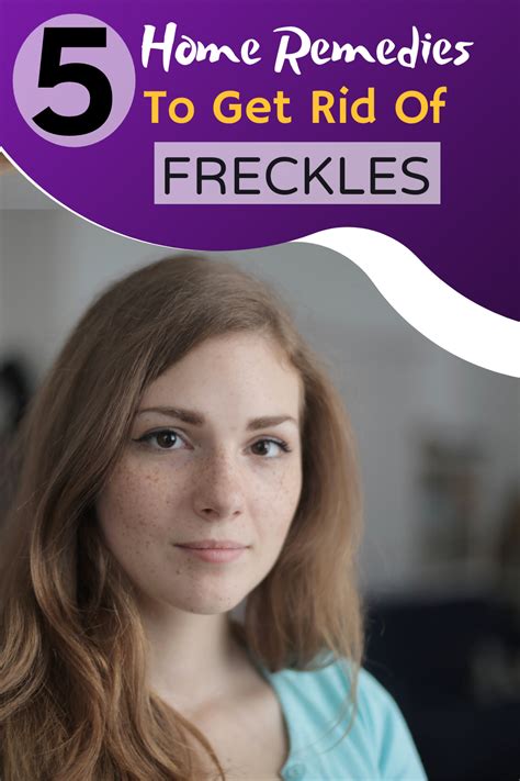 How To Get Rid Of Freckles In 2020 Getting Rid Of Freckles Freckle