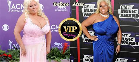 Beth Chapman Plastic Surgery Before And After
