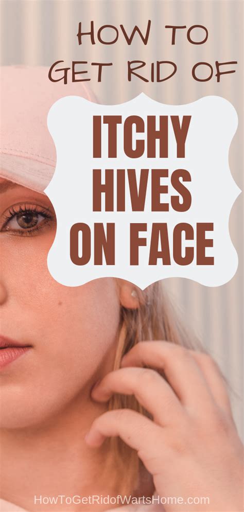 Hives On Face Causes And Symptoms How To Get Rid Of Facial Rash