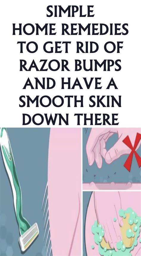 Simple Home Remedies To Get Rid Of Razor Bumps And Have A Smooth Skin