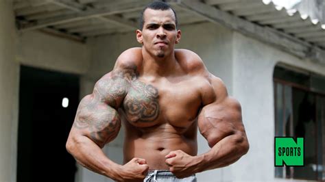 Brazilian Bodybuilder Nearly Has Arms Amputated After Turning Into Real