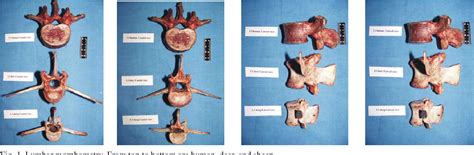 Pdf Morphometry Research Of Deer Sheep And Human Lumbar Spine