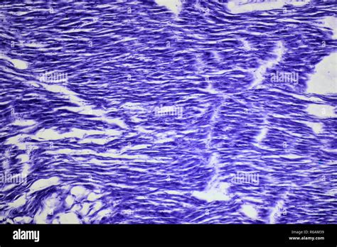 Human Heart Muscle Under Microscope Stock Photo Alamy