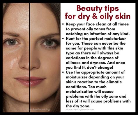 Beauty Tips For Combination Skin Combination Skin Usually Has A Mix Of