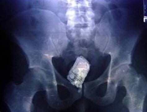 31 Funny X Ray Images That Seem Too Ridiculous To Be Real