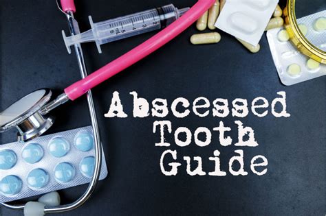 How To Drain A Tooth Abscess At Home Rockville All Smiles