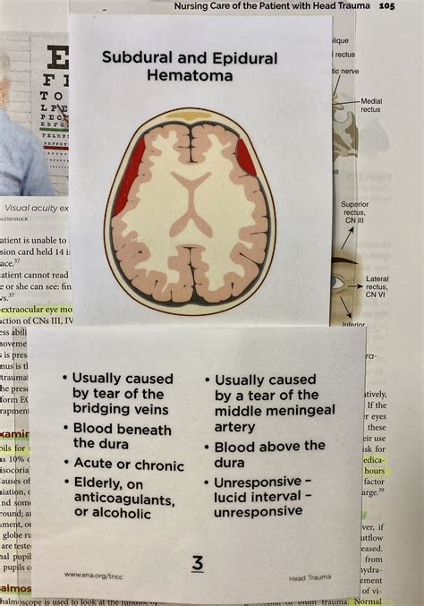 Symptoms Of Subdural And Epidural Hematoma Epidural Epidural Hematoma