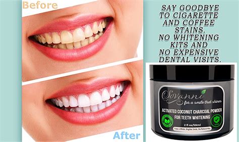 She wrapped her teeth in tin foil, now look at what happened! Amazon.com : Sovanni Teeth Whitening Charcoal Powder ...