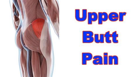 How To Deal With Glute Medius Pain Sore Butt Youtube